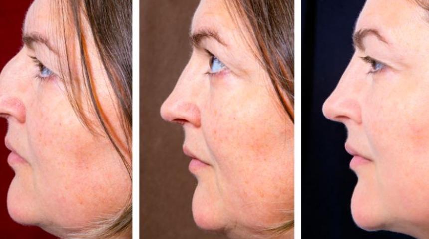 Gıdınızın Sarkmaması İçin Yapmanız Gereken 5 Şey