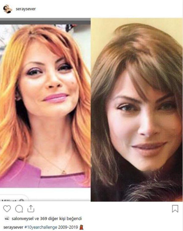 SERAY SEVER