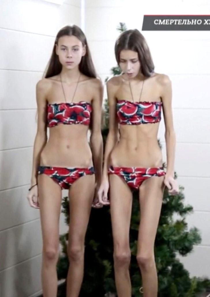 'Daha çok zayıflamalısınız' Bu söz canından ediyordu! G5