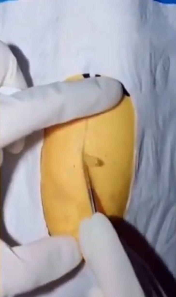 Cerrah baba oğluna meyvelerle nasıl ameliyat yapıldığını anlattı G2