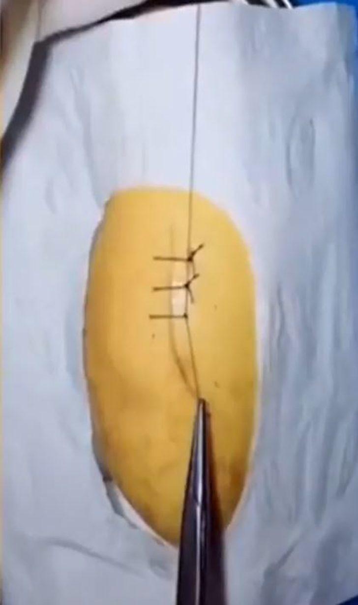 Cerrah baba oğluna meyvelerle nasıl ameliyat yapıldığını anlattı G3