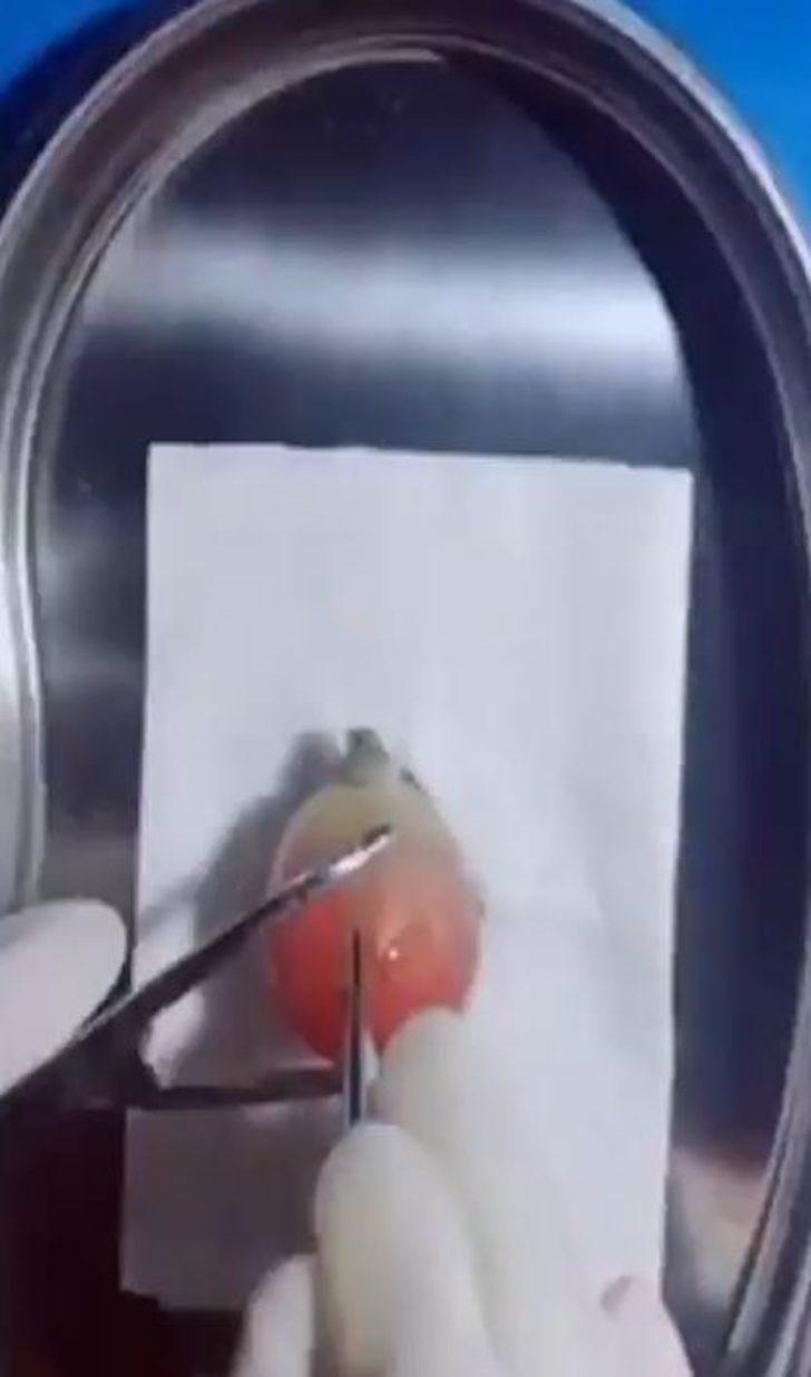 Cerrah baba oğluna meyvelerle nasıl ameliyat yapıldığını anlattı G5