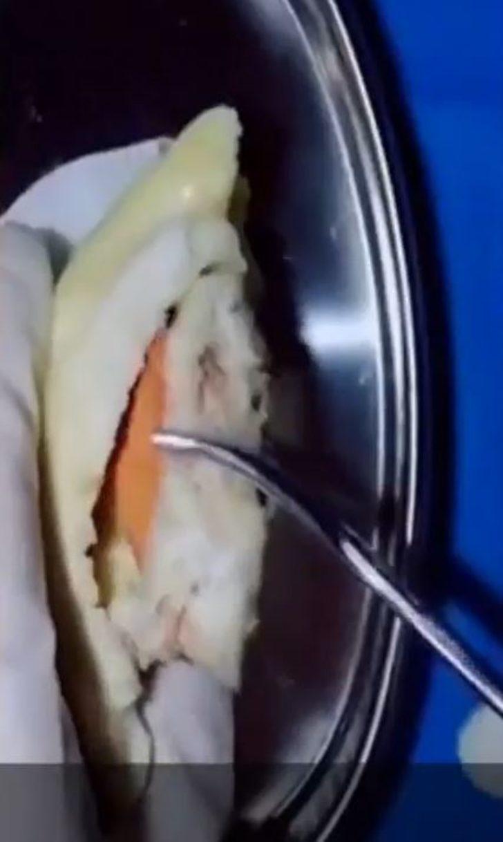 Cerrah baba oğluna meyvelerle nasıl ameliyat yapıldığını anlattı G4