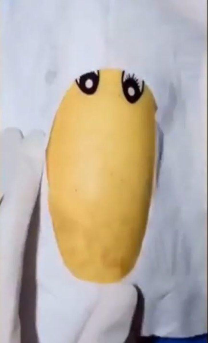 Cerrah baba oğluna meyvelerle nasıl ameliyat yapıldığını anlattı G1