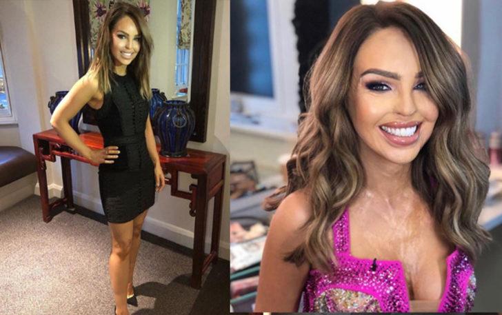 Eski sevgilisi tecavüz edip yüzüne asit fırlattı! 10 years challenge fotoğrafı şok etti G5