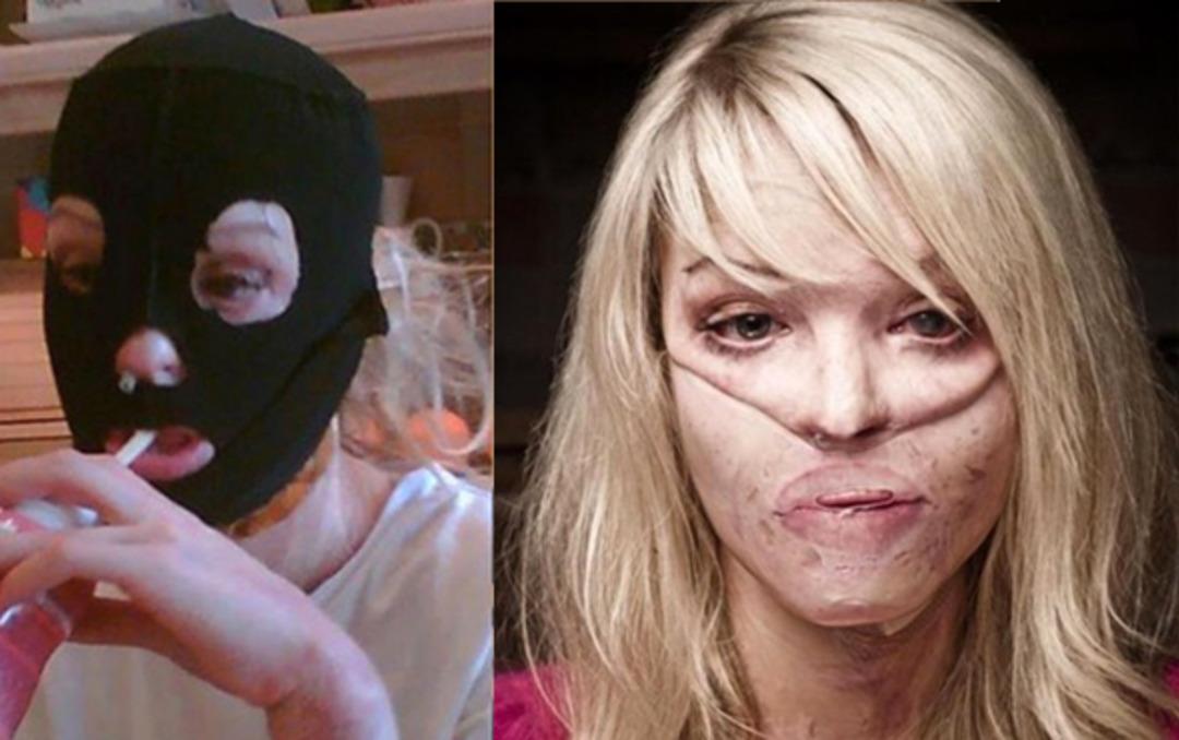 Eski sevgilisi tecav&uuml;z edip y&uuml;z&uuml;ne asit fırlattı! 10 years challenge fotoğrafı şok etti