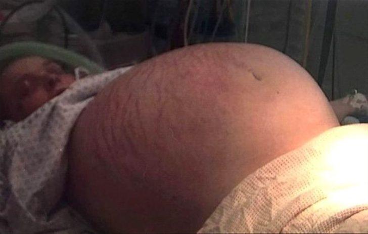 Gelmiş geçmiş en ilginç hastalıklar G4