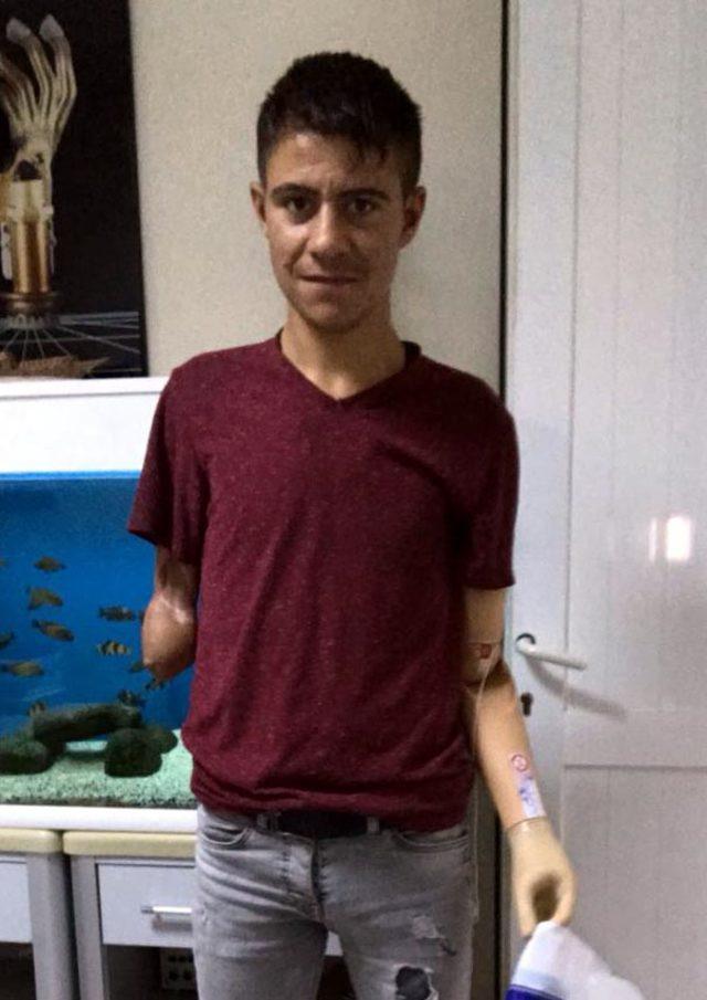 Kuşu kurtarırken ellerinden olan Ramazan'a protez kol takıldı