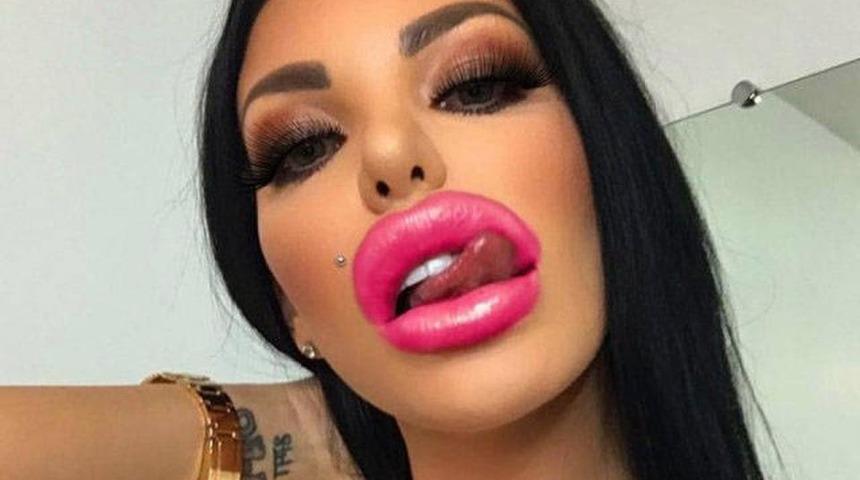 Bunu da gördük: Porno Yıldızı Dudağı!