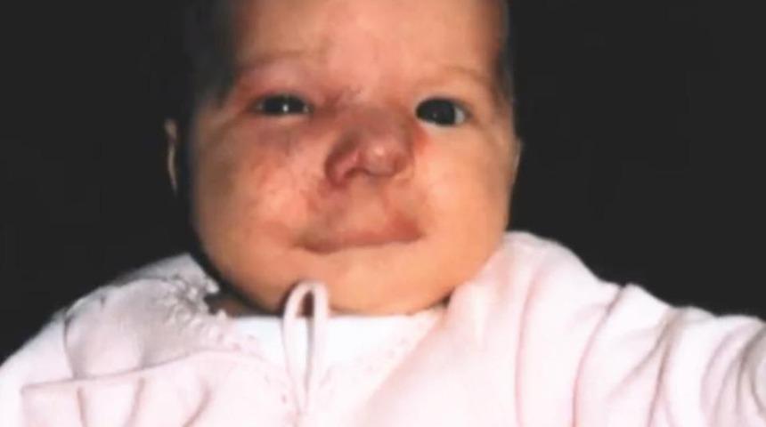 Küçük bir doğum lekesiyle doğdu 14 yıl içinde bu hale geldi