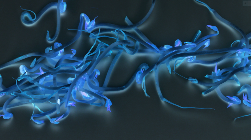 Toksoplazma nedir, nasıl bulaşır? Toksoplazma parazitinden korunma yolları nelerdir?