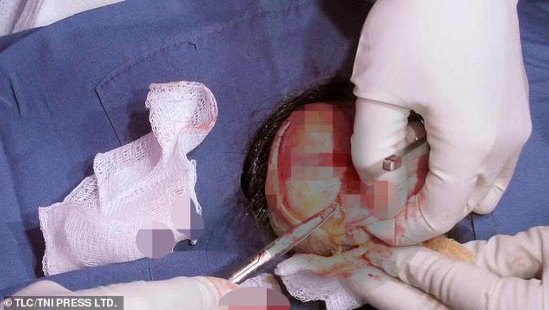 Hepsini kayda aldı! Dev kisti b&ouml;yle s&ouml;k&uuml;p attı