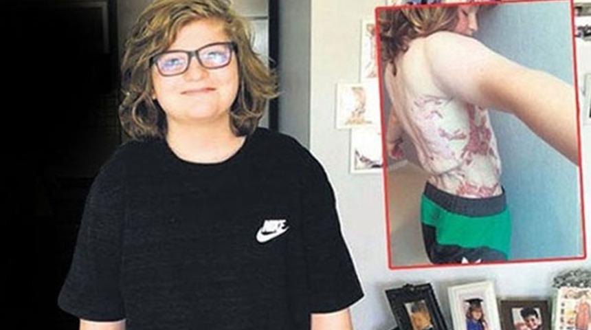 İzmir'de okul kantinindeki semaver faciasında karar çıktı! Okul müdürü ve kantin işletmecilerine şok