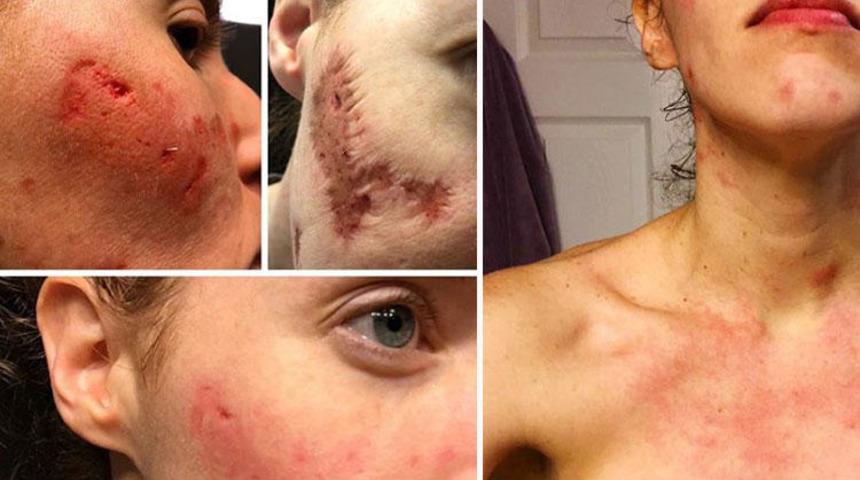 Seyahat ederken kaptı, yüzünü yemeye başladı