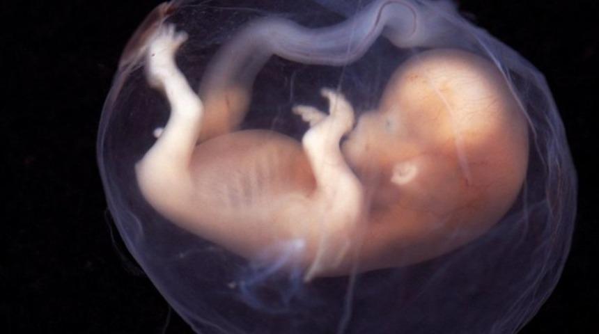 Bir erkek, iki kadın! '&Uuml;&ccedil; ebeveynli &ccedil;ocuk'