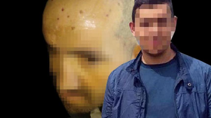 Engelli vatandaşın kafasında sigara s&ouml;nd&uuml;ren kişiye ders gibi ceza! Kendini b&ouml;yle savundu