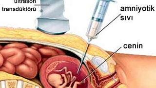 Gebelik takibinde tarama testlerinin önemi nedir?