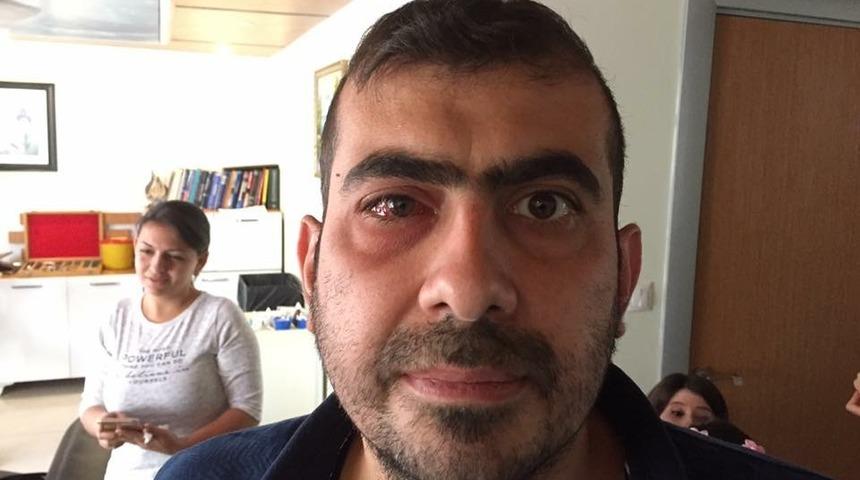 Iraklı hasta şifayı Doktor&ouml;z G&ouml;z&rsquo;de buldu