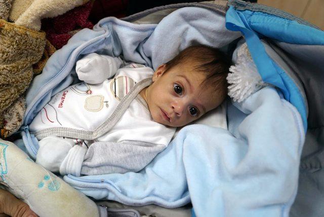 Suriye’de prematüre doğan Yezan bebek Türkiye’de sağlığına kavuştu