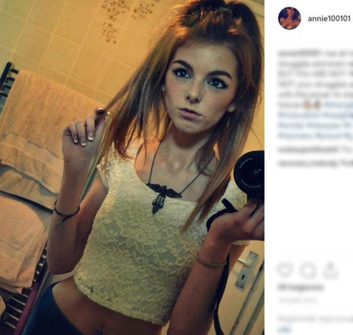 Anoreksiya hastası çikolatayla hayata döndü! İşte son hali G3