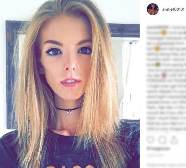 Anoreksiya hastası çikolatayla hayata döndü! İşte son hali G4