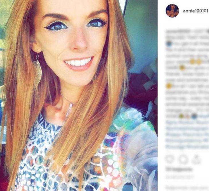 Anoreksiya hastası çikolatayla hayata döndü! İşte son hali G5