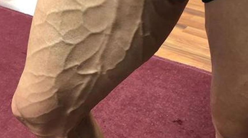 Bursasporlu Latovlevici'nin bacağının hali olay yarattı