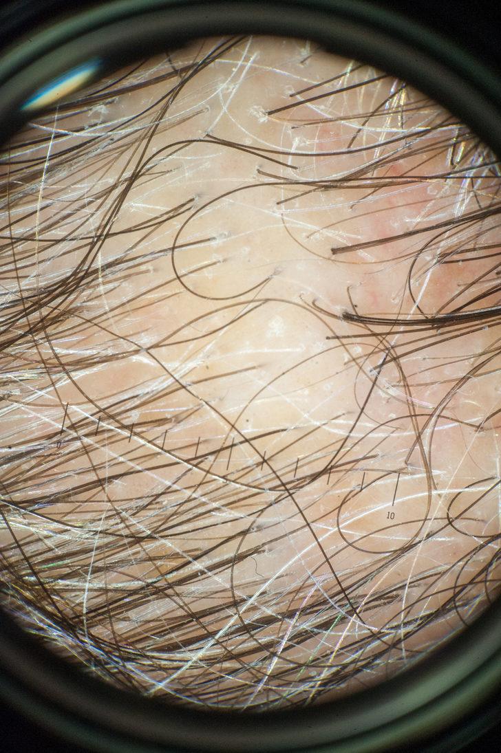 Çorba olmaktan çok öte! Mucize faydalarıyla şaşırtıyor G3