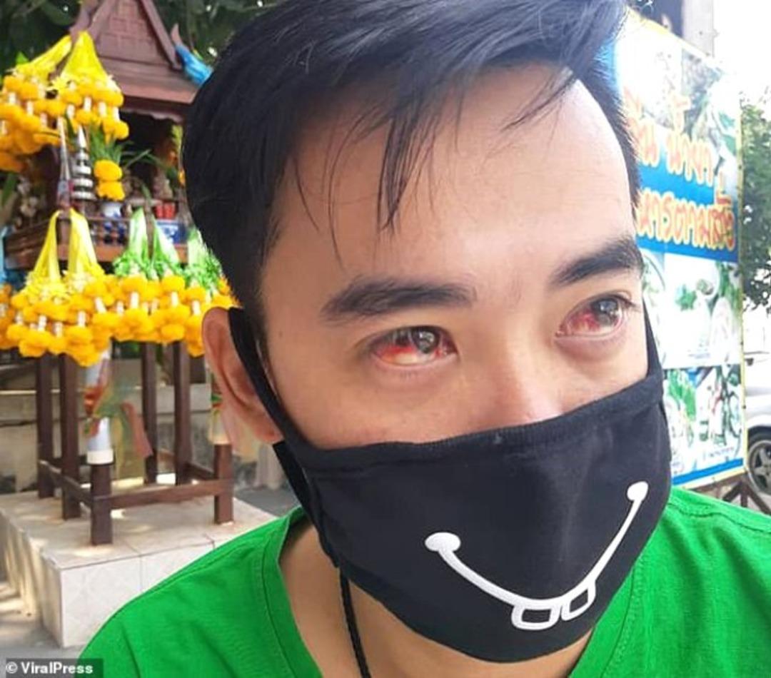 Hava kirliliği y&uuml;z&uuml;nden vatandaşlar kan &ouml;ks&uuml;r&uuml;yor!