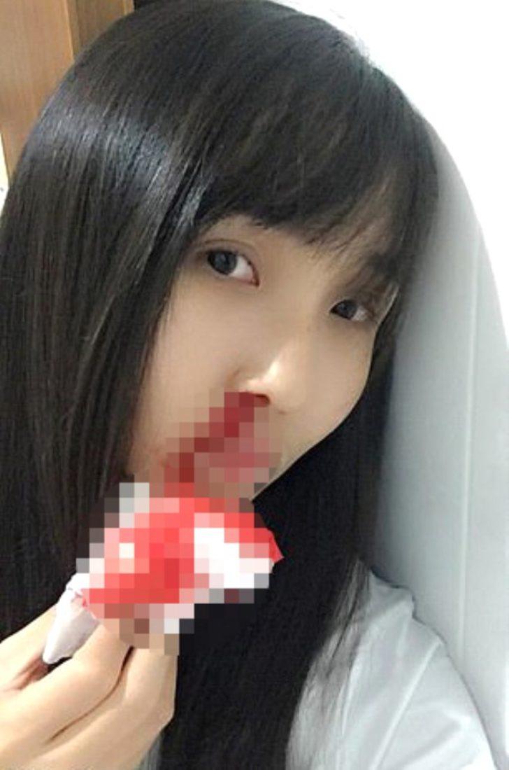 Hava kirliliği yüzünden vatandaşlar kan öksürüyor! G2