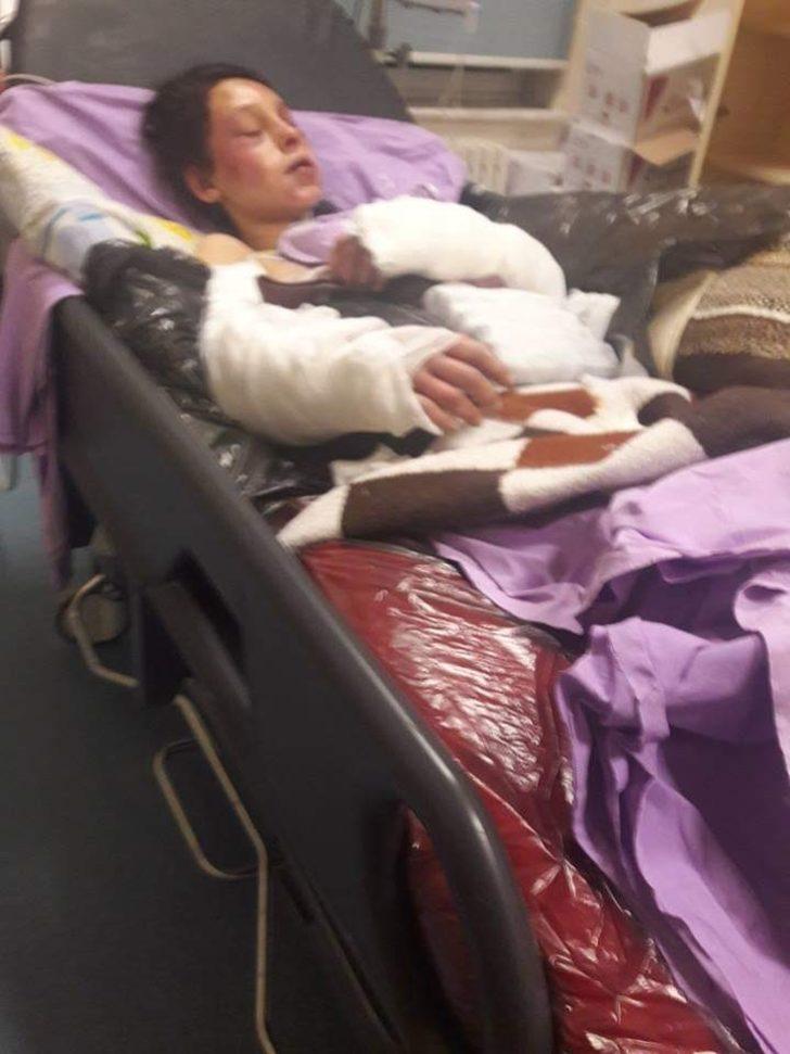 5 aylık hamileydi, tanınmaz hale geldi! Gerçek öldüğü sanılınca ortaya çıktı G2