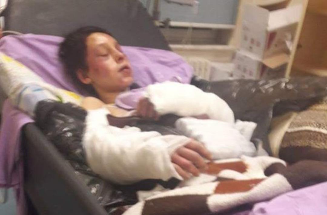 5 aylık hamileydi, tanınmaz hale geldi! Ger&ccedil;ek &ouml;ld&uuml;ğ&uuml; sanılınca ortaya &ccedil;ıktı