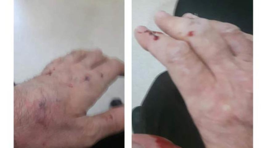 Taksicinin elleri bu hale geldi! Gasp dehşeti