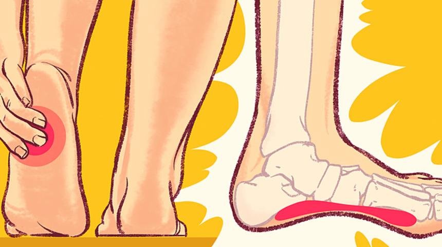 Ağrılı topuk dikenlerinden kurtulmanın etkili yolları