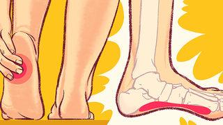 Ağrılı topuk dikenlerinden kurtulmanın etkili yolları