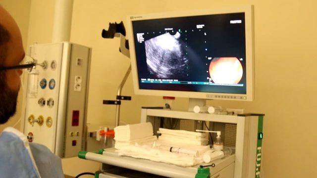 Kayseri Şehir Hastanesinde EUS yöntemi kullanılmaya başlandı