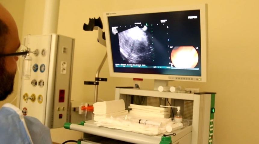 Kayseri Şehir Hastanesinde EUS y&ouml;ntemi kullanılmaya başlandı