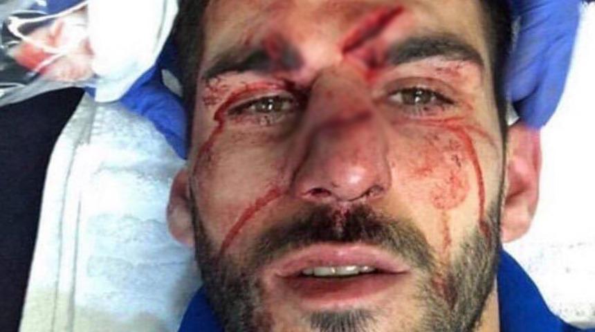 Nelson Oliviera kanlar i&ccedil;inde yerde kaldı