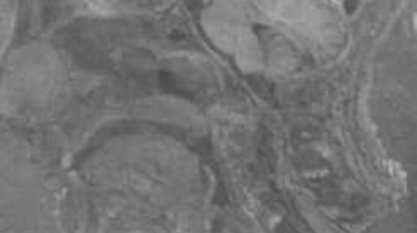 Korkun&ccedil; Nazi deneyleri