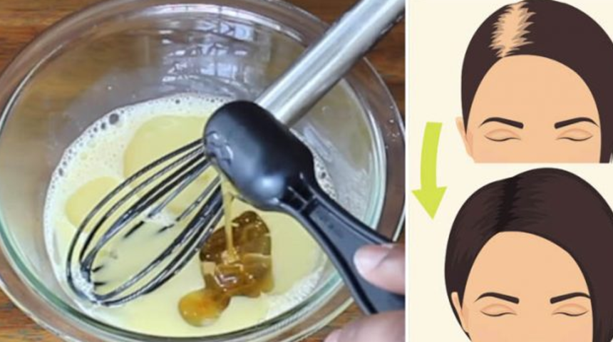 Saç dökülmesine çözüm olan en etkili 3 malzeme