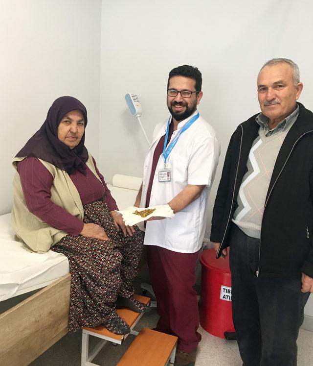 Safra kesesinden 311 taş çıktı
