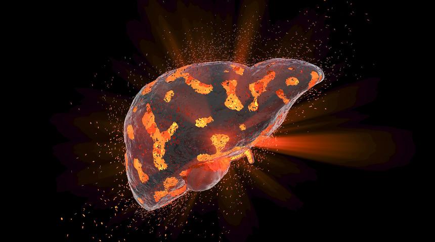 Paketli atıştırmalıkların zararı nedir? Karaciğer sağlığınızı korumak i&ccedil;in &ouml;neriler... 