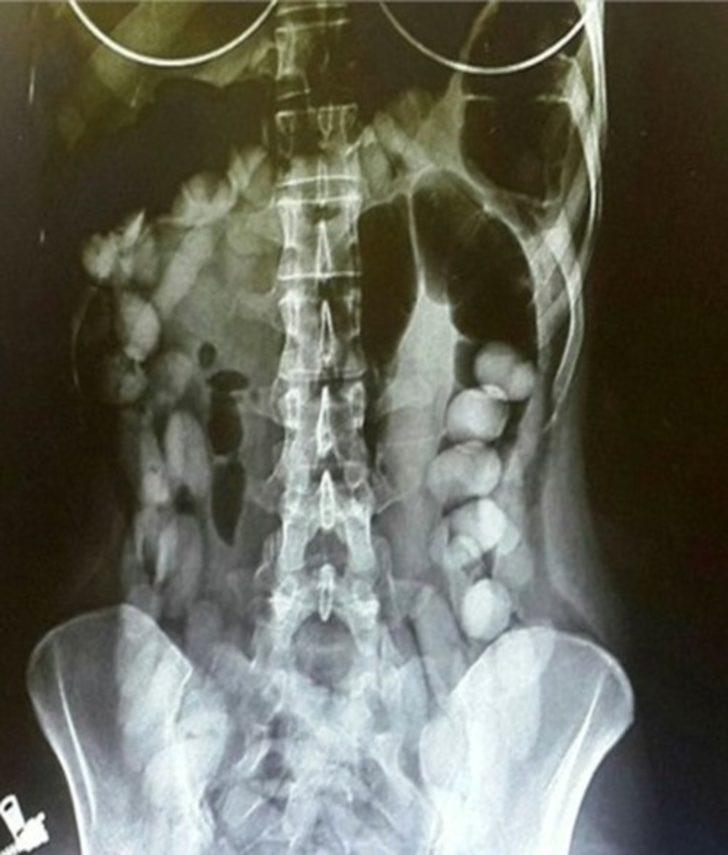 'Pes' dedirten olay!  Adliyedeki zanlılara ekmek arası uyuşturucu G5