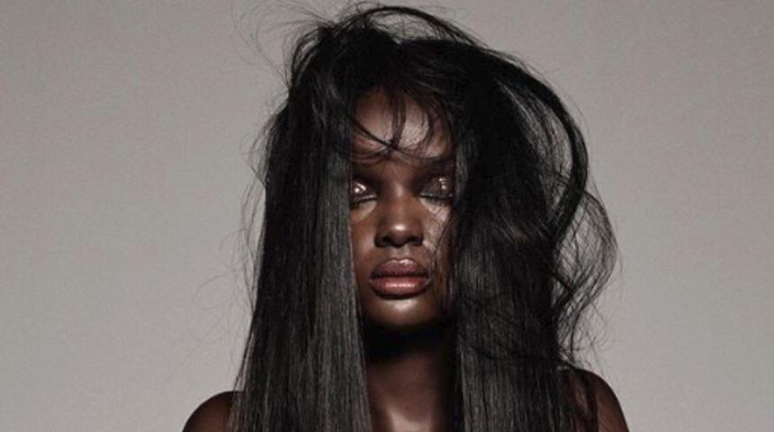 Zorbalığı motivasyona çevirdi şimdi ünlü markalar peşinden koşuyor