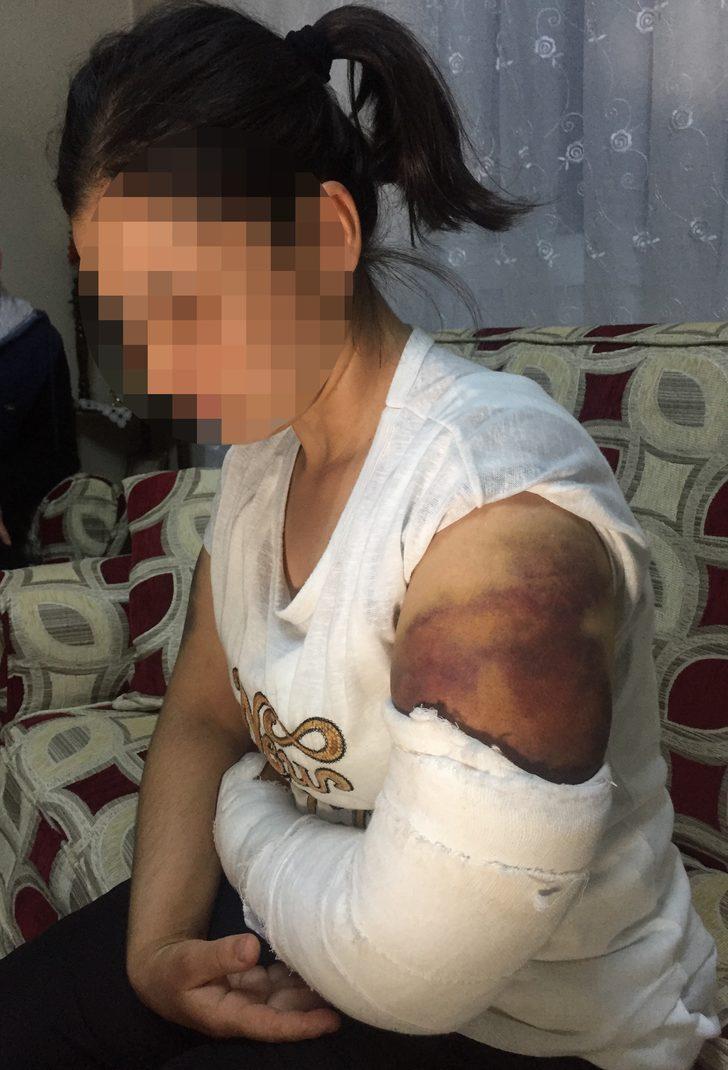 30 dakika boyunca inşaat demiriyle dövdü! G2