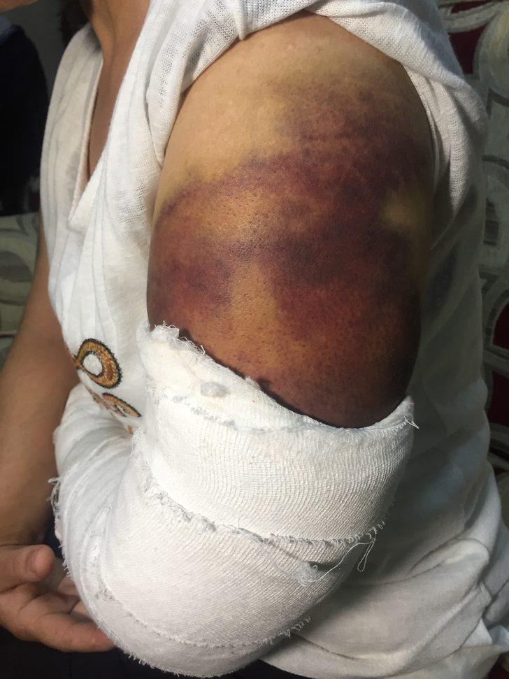 30 dakika boyunca inşaat demiriyle dövdü! G3