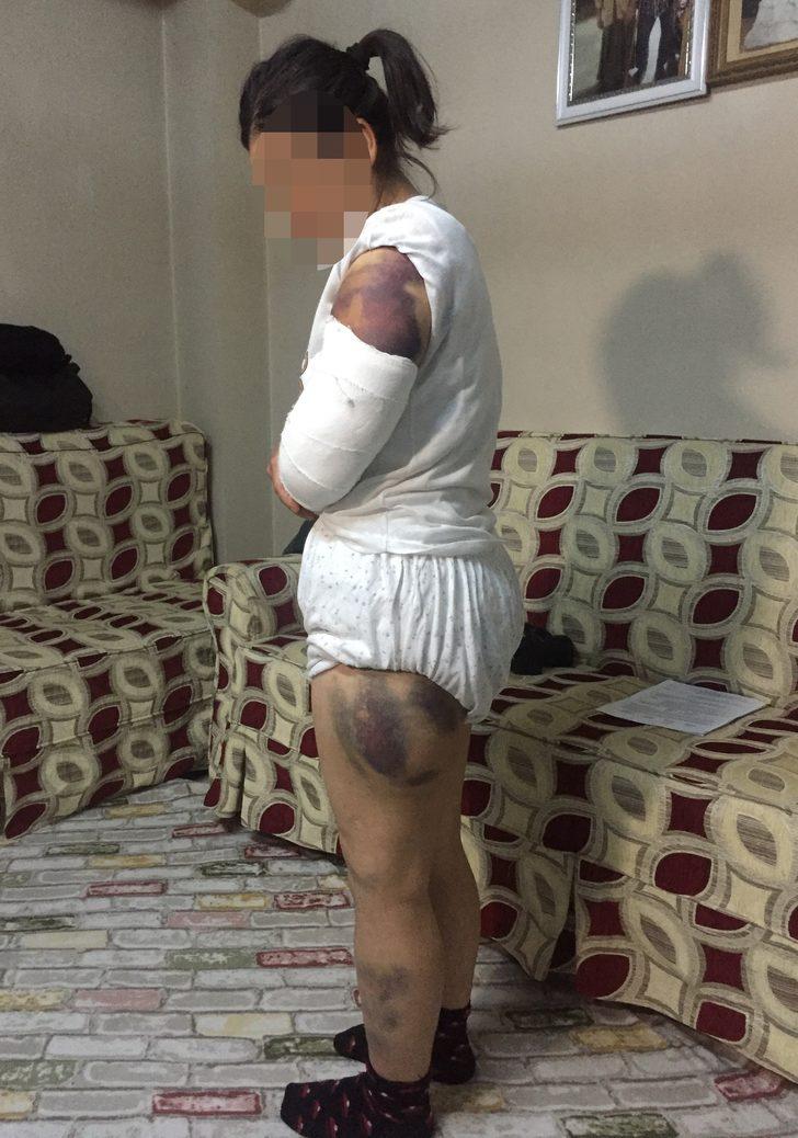 30 dakika boyunca inşaat demiriyle dövdü! G4