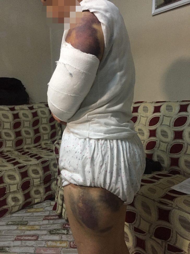 30 dakika boyunca inşaat demiriyle dövdü! G5