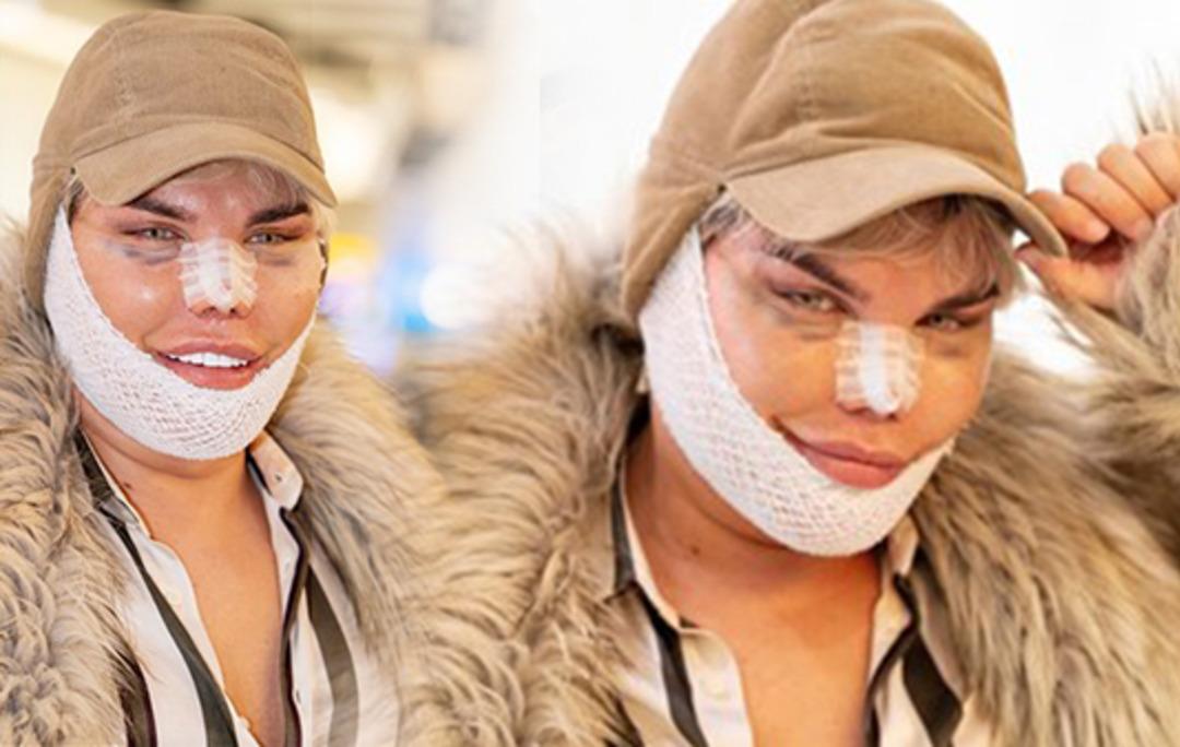 Bir kez daha bı&ccedil;ak altına yattı! Son hali inanılmaz