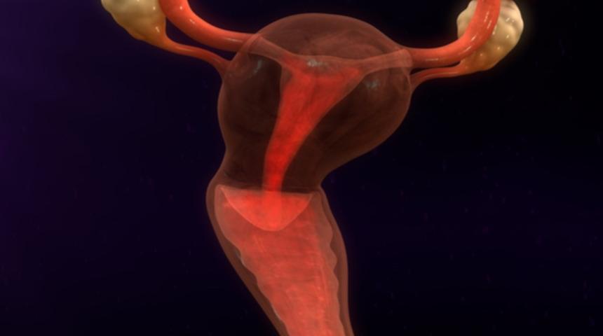 Robotik miyomektomi nedir her hastaya uygulanabilir mi?